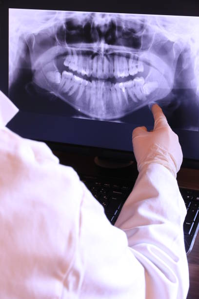 Best Emergency Dentist for Lost Fillings or Crowns in Highland, IL